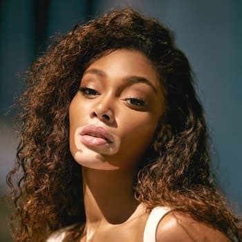 Winnie Harlow Biography: Husband, Net Worth,。